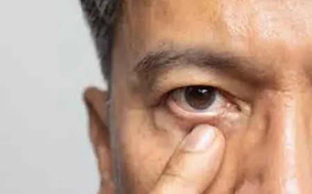 मोतीबिंदू कशामुळे होतो? – कारण, लक्षणे व प्रतिबंध